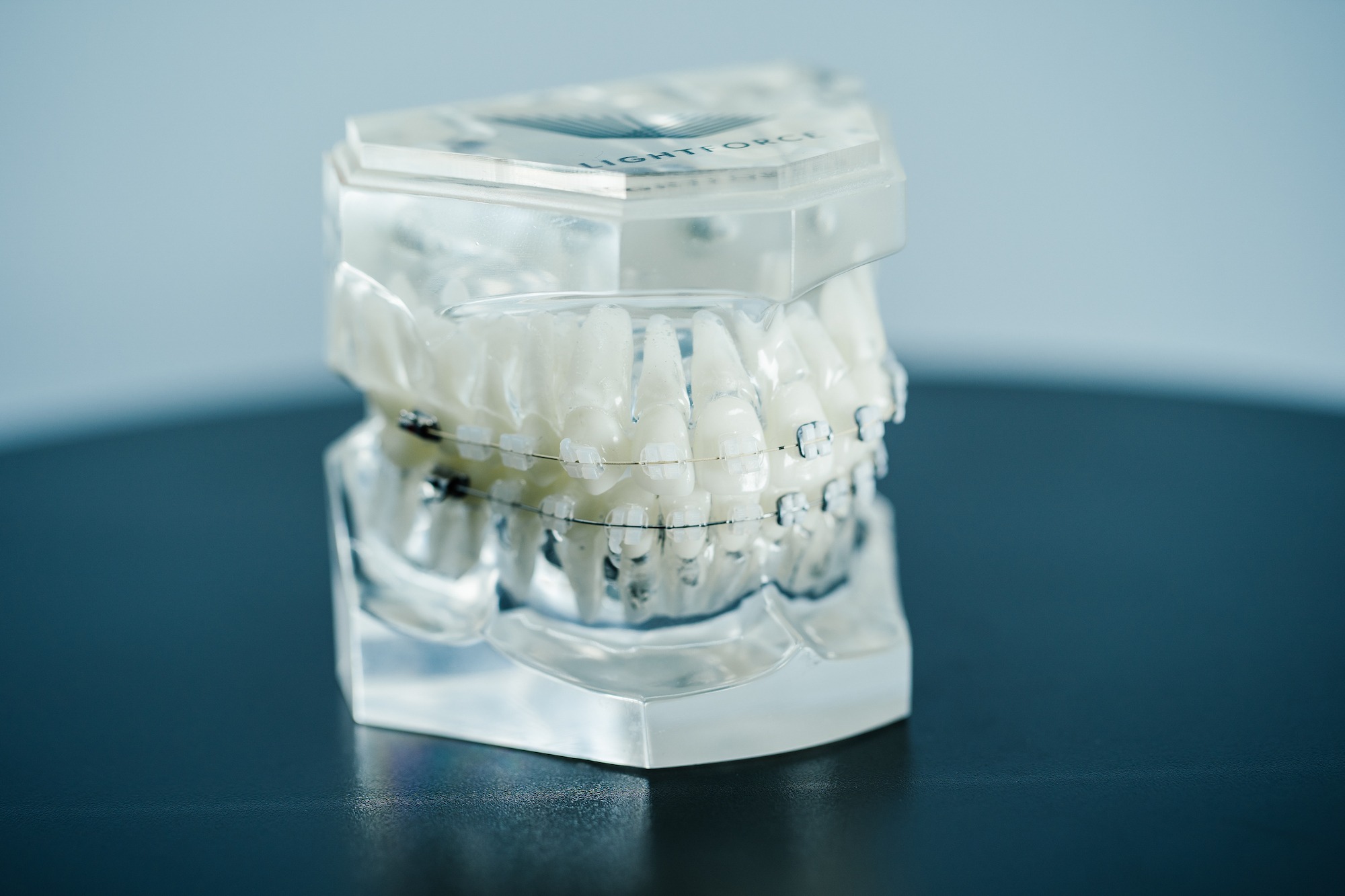 invisalign aligners on plastic model